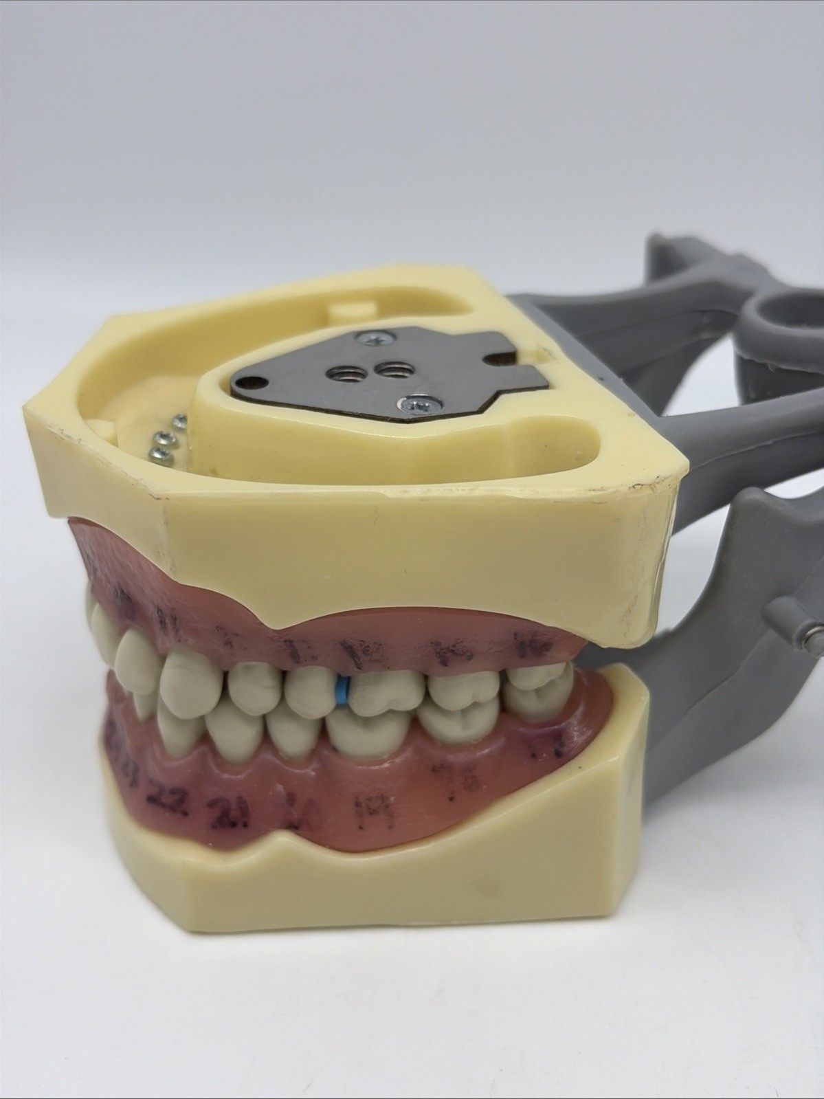 US Columbia Dental Typodont Model 32pcs Removable Teeth Exam