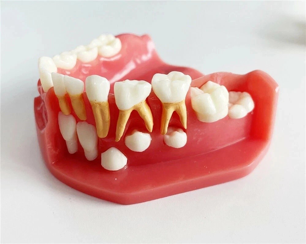 Dental Teaching Pediatrics Teeth Children 5-9Years Old Permanent Alternate Model