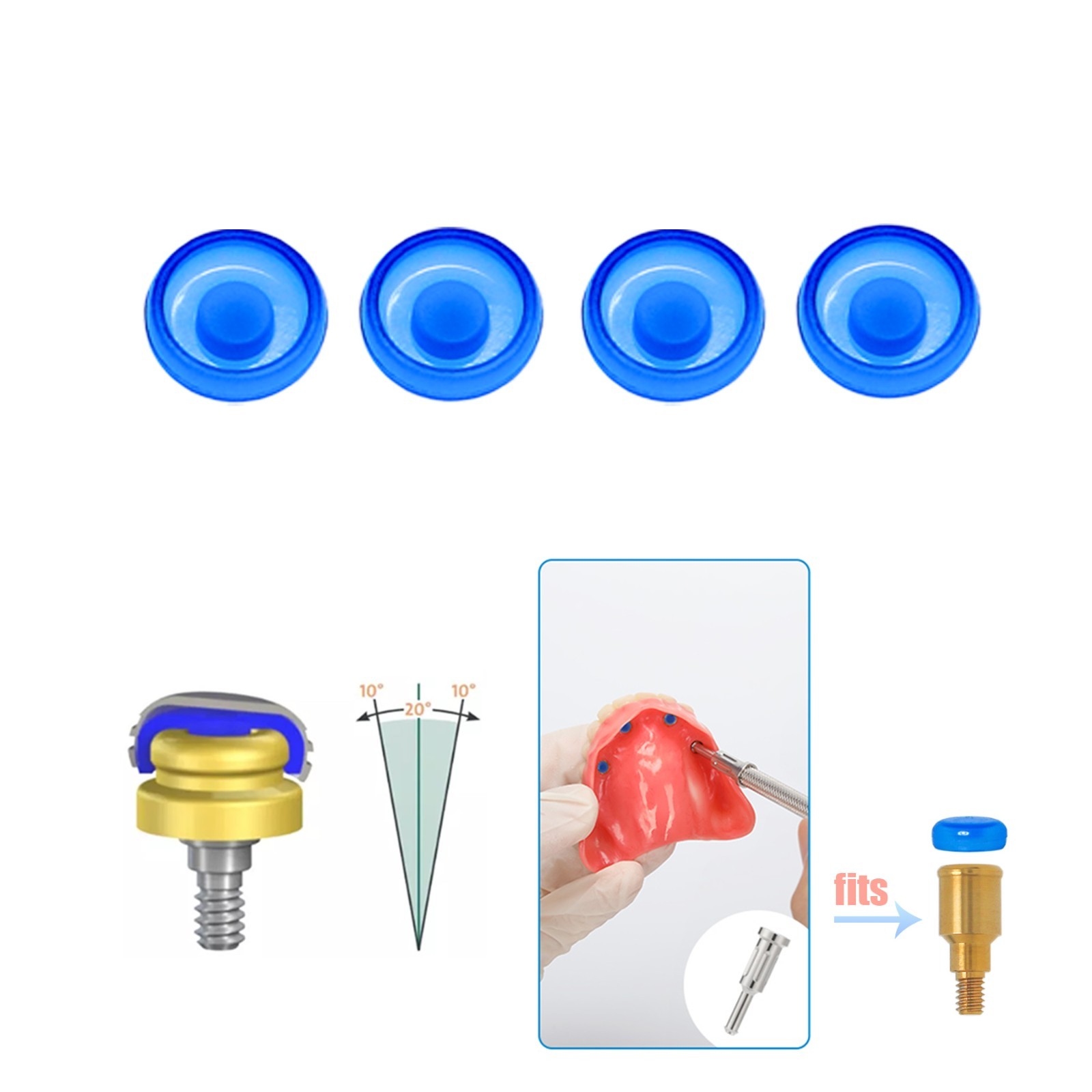 Dental Overdenture Locator Implant Male Cap Retention Inserts Kit PEEK Core Tool