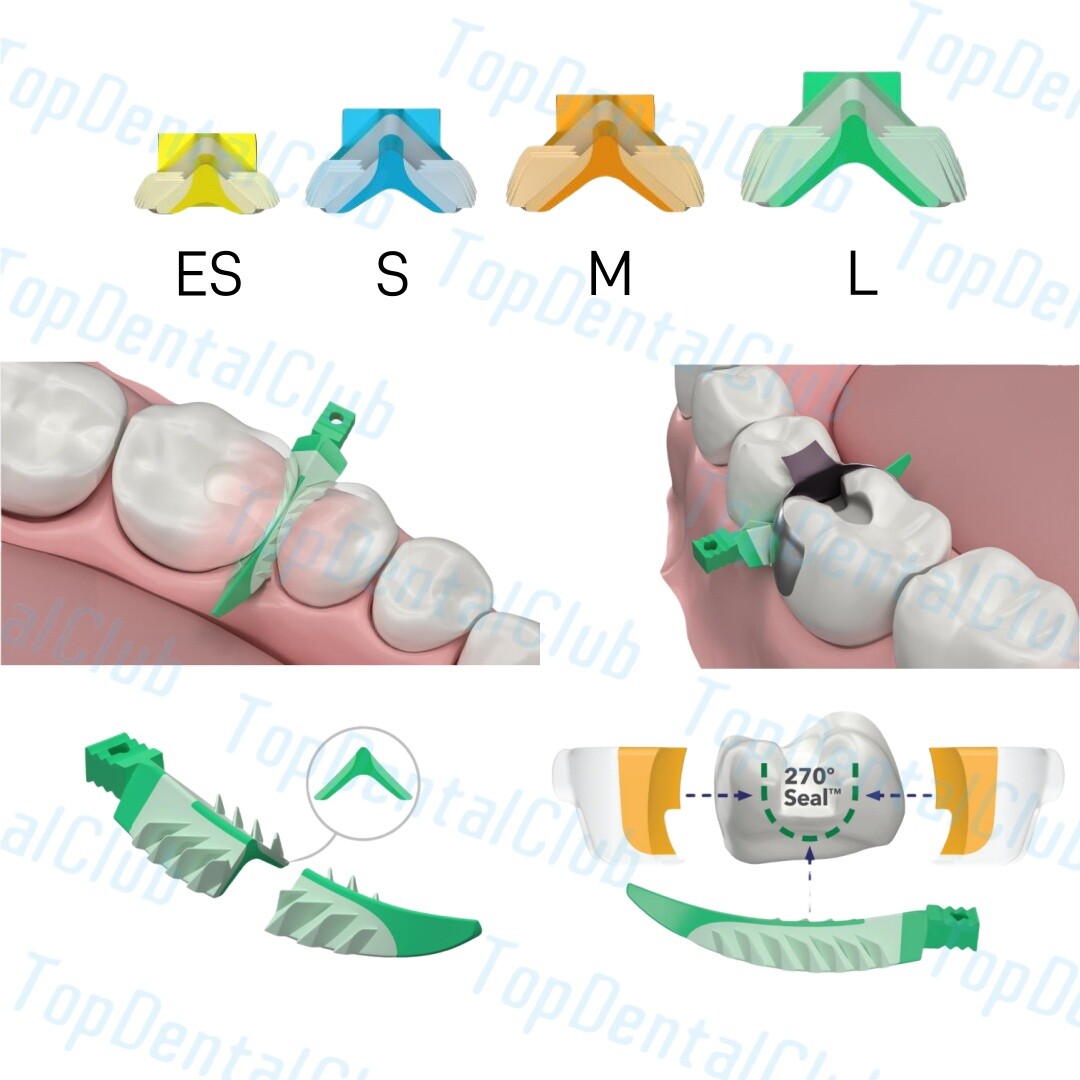 L Dental Composite Wedge Strata Wedges Soft Face Cervical Seal Diastema Matrix