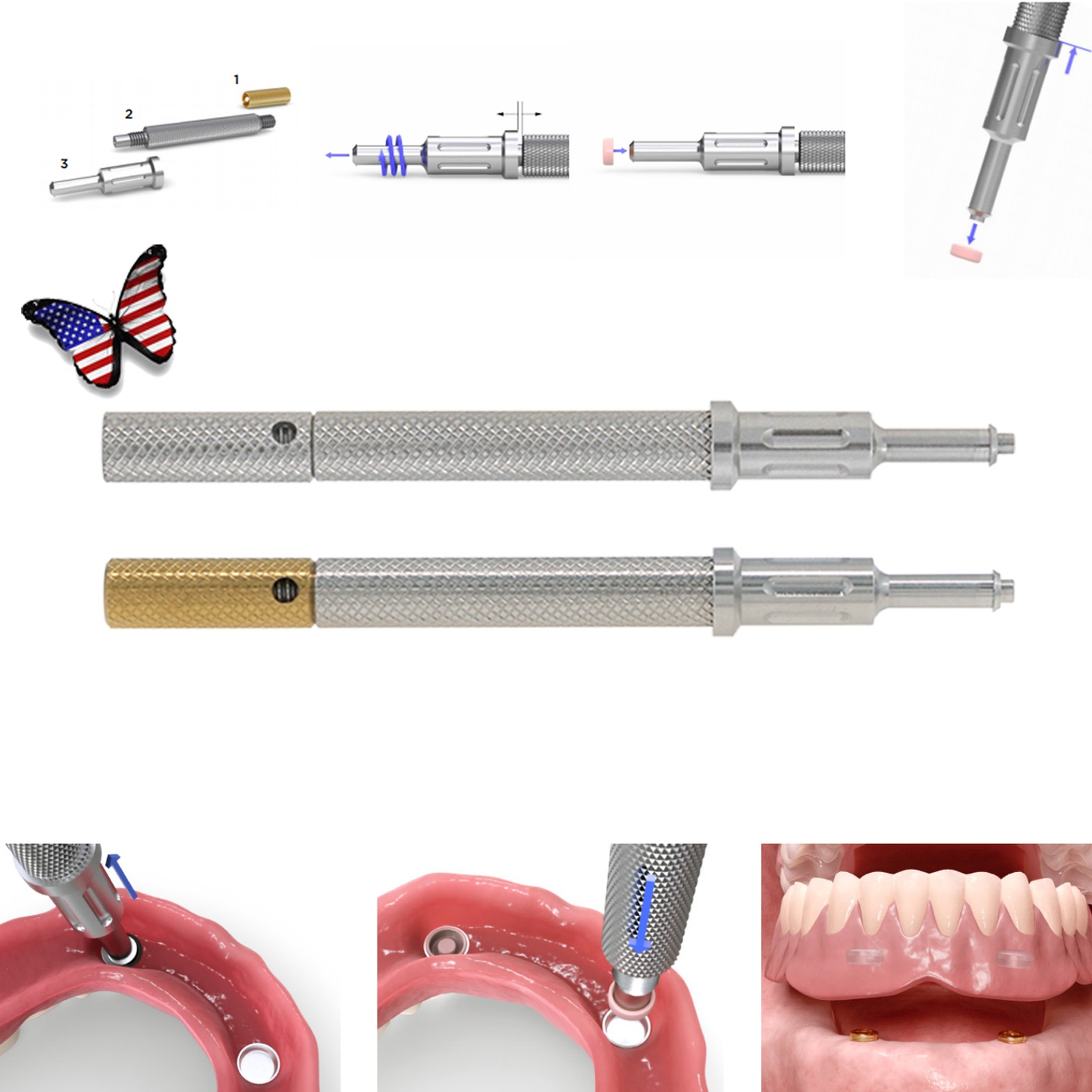 US Dental Locator Abutment Fits Zimmer TSV 3.5/4.5 NP/RP 1-5mm GH Internal Hex