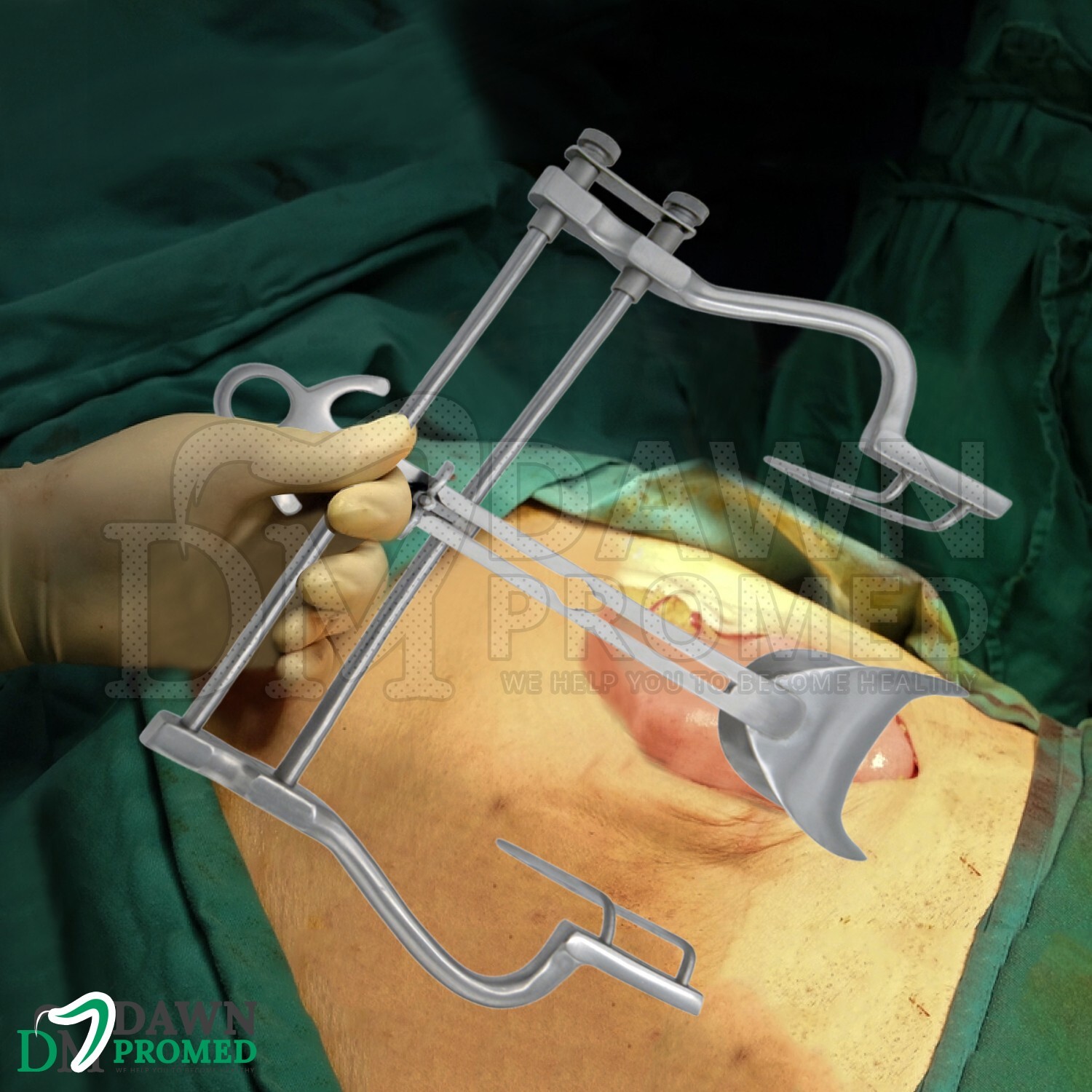 Balfour Abdominal Retractor 10″ Spread Fenestrated Blades Medical German Grade