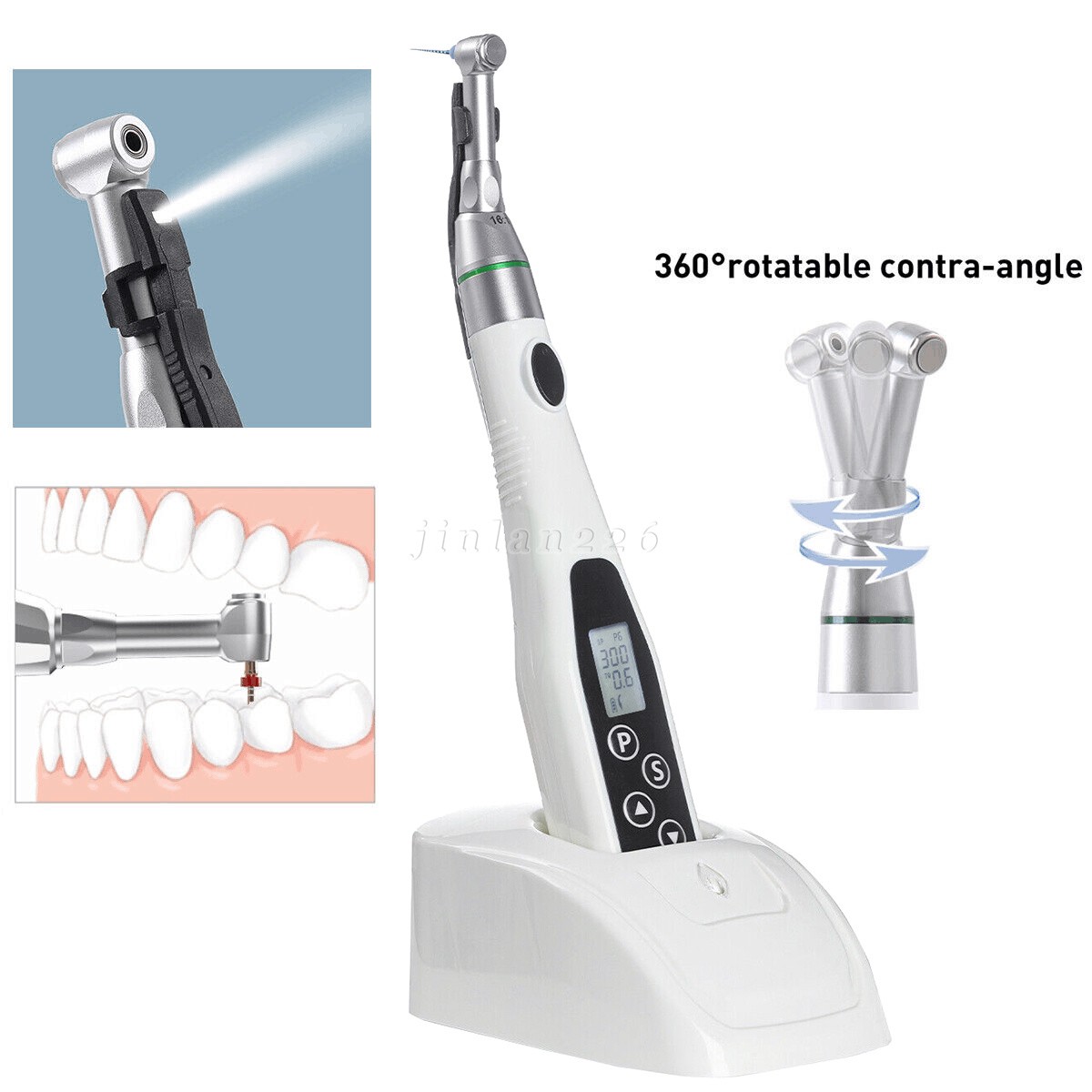 Dental Wireless Led Endo Motor For Root Canal Treatment（Contra Angle 16：1）