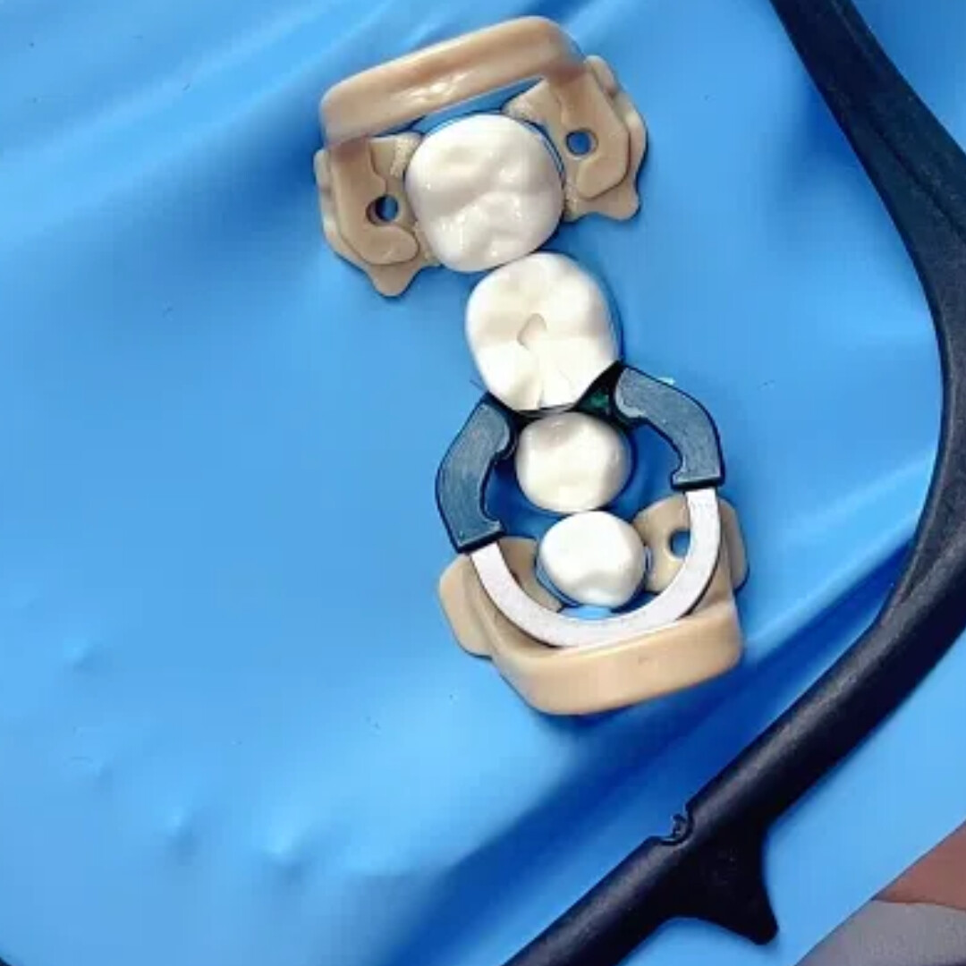 Dental Matrix Bands Ring Sectional Matrice Clamp Fit Palodent V3 US USA Stock
