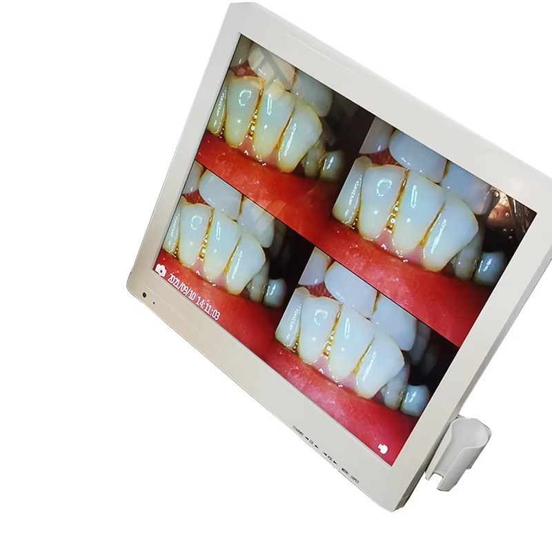 17 Inch Monitor Dental Camera Intraoral Digital Imaging Intra Oral 8 LED