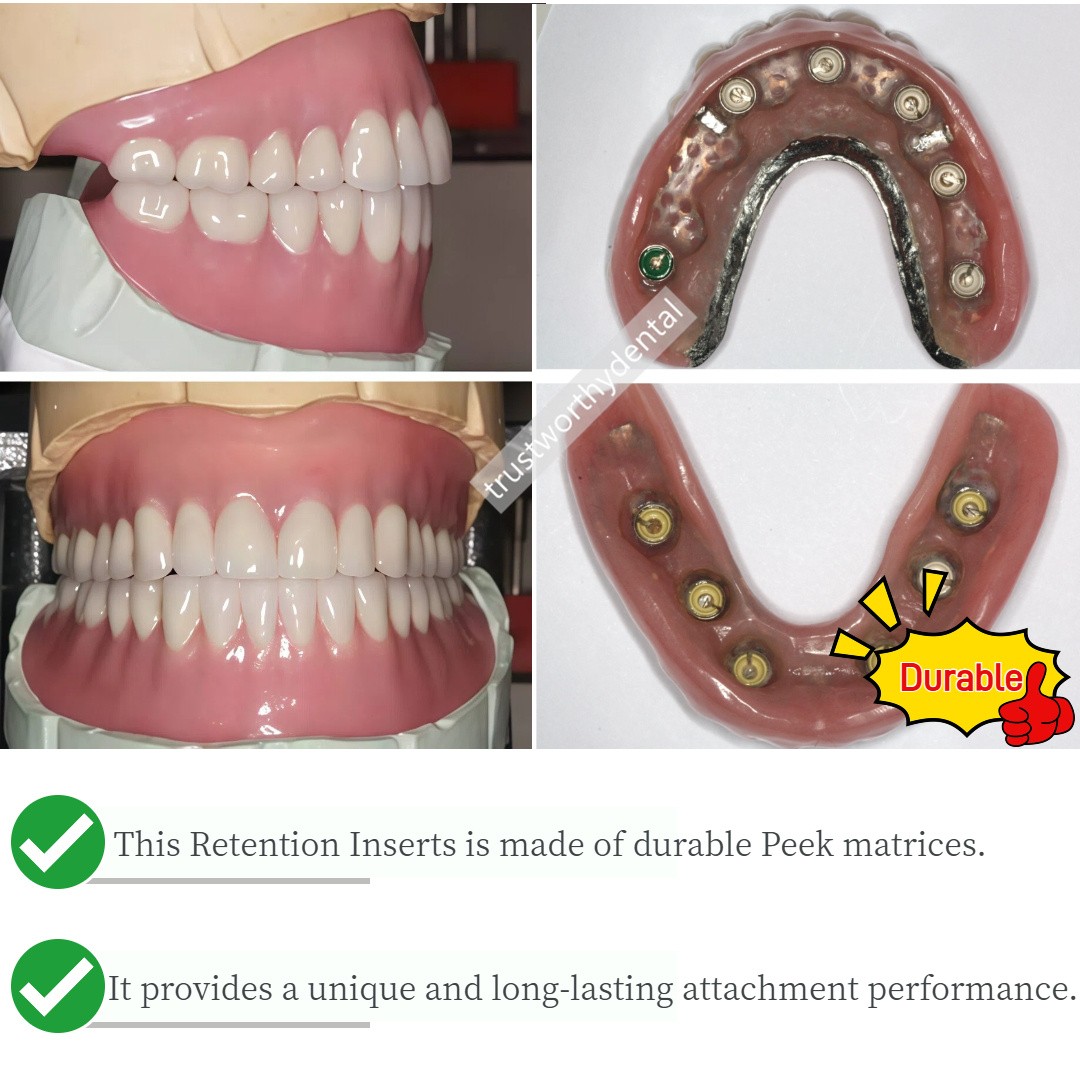 Dental Novaloc Retention Inserts Caps Peek Matrix Locator Housing Mounting Tool