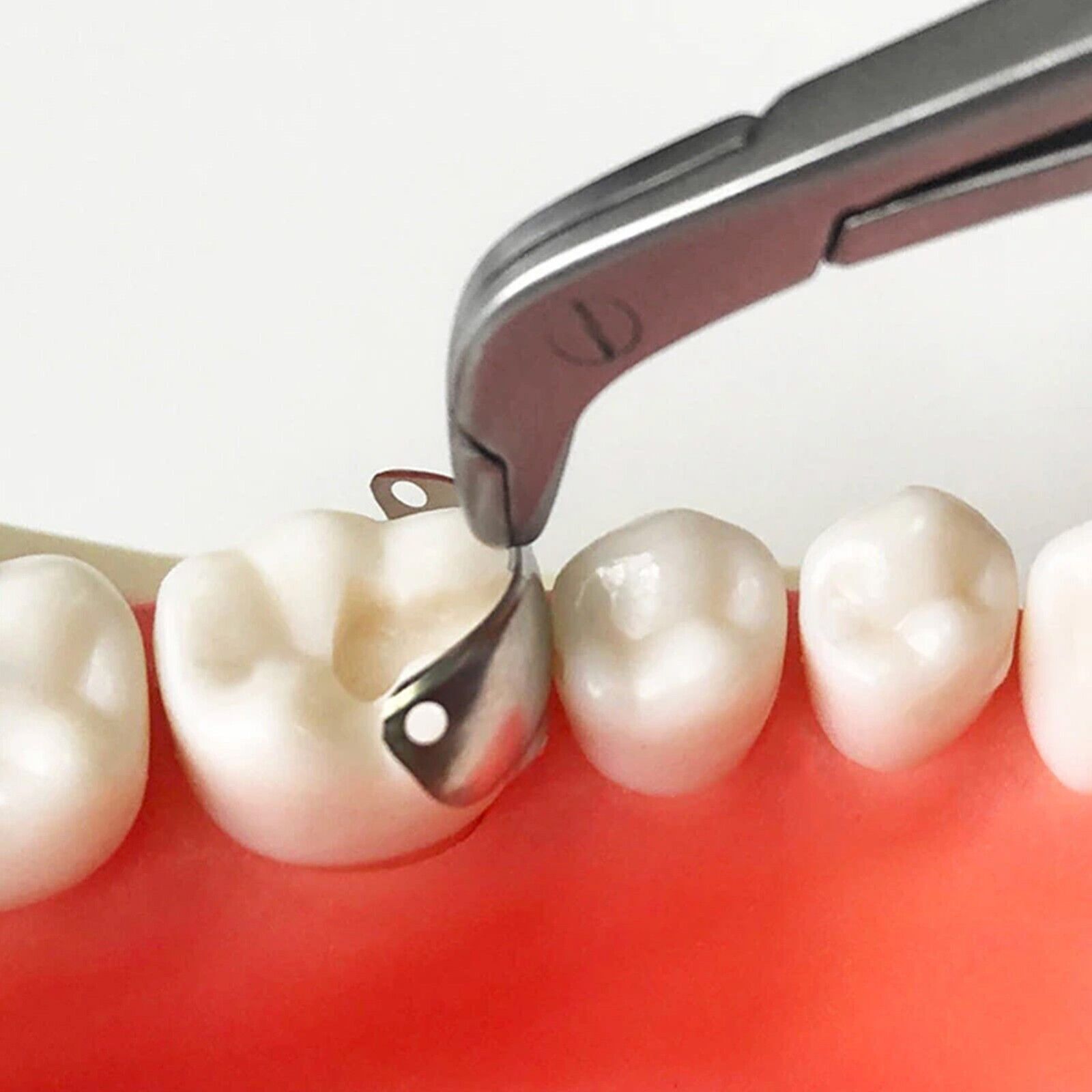 Dental Matrix Bands Ring Narrow Standard Ring Titanium Clamp Fit Garrison V3