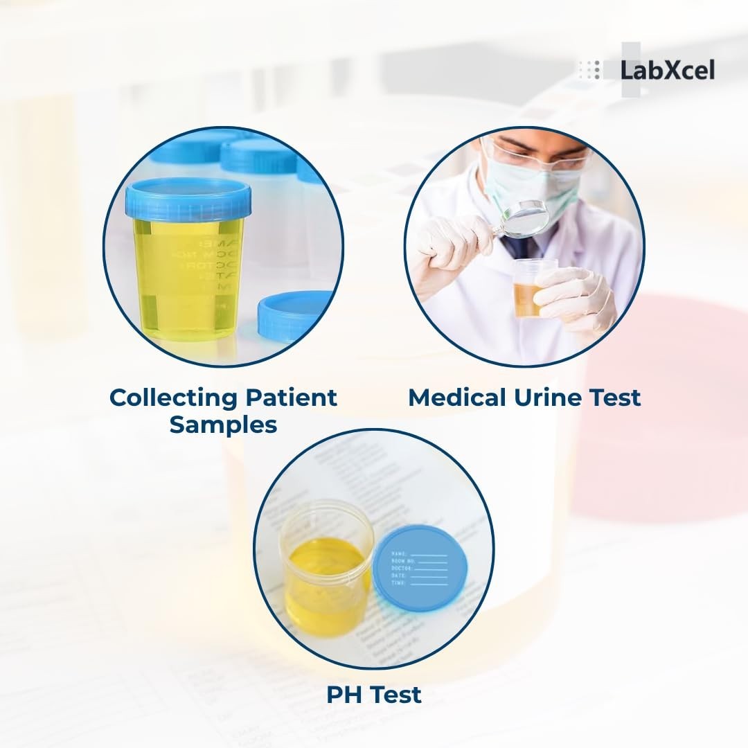 LabXcel Specimen Containers 120mL Polypropylene Screw Cap Sample Collection Cup