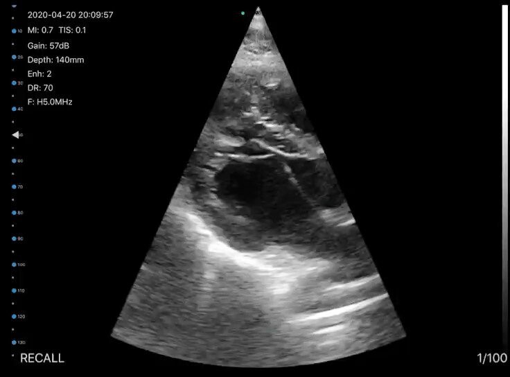Wifi Wireless Pocket Ultrasound BUY USA, Cardiac Linear Convex Color Doppler