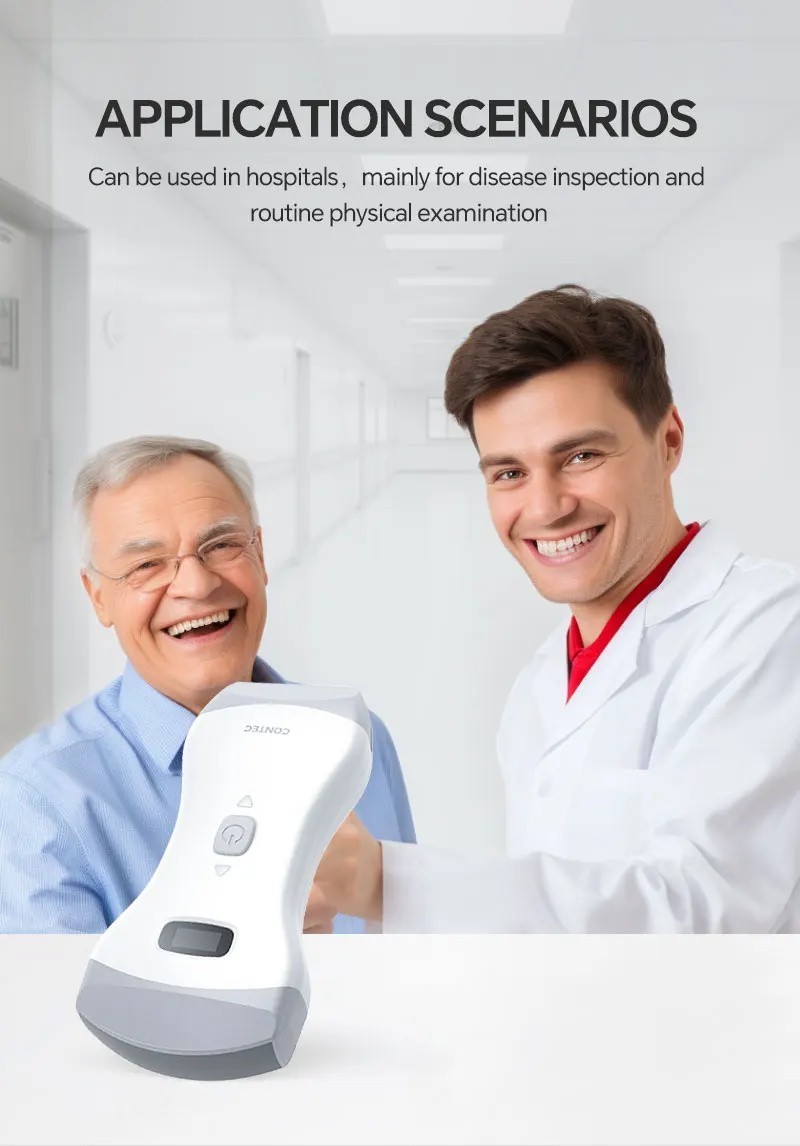 Wireless color Doppler ultrasound device with 3-in-1 convex probe