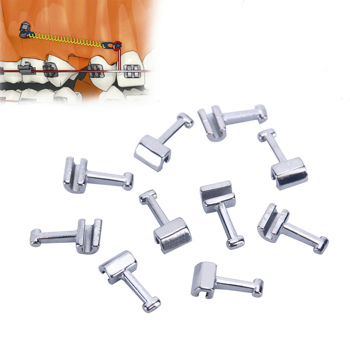 AZDENT Dental Orthodontic Crimpable Hook Sliding Cross Tube Stops Type 10Pc/Set