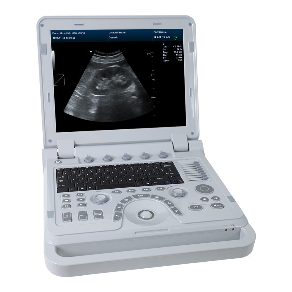 Portable Ultrasound Scanner Color Doppler Laptop Machine Convex TransVaginal CF