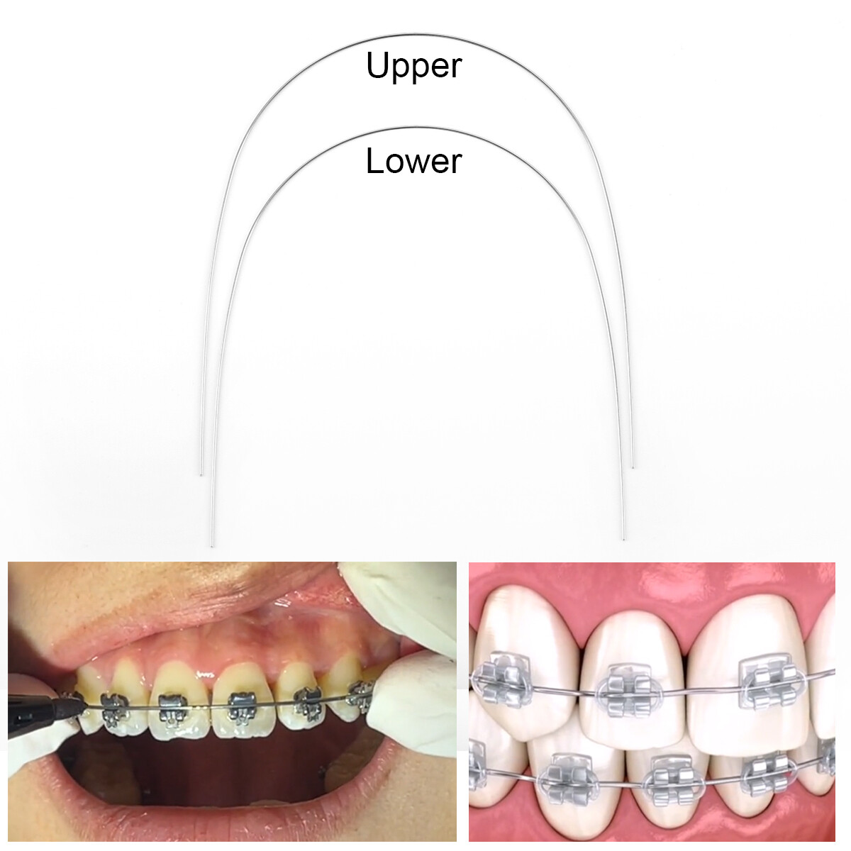 AZDENT Dental Orthodontic Super Elastic Round Niti Arch Wire Nature Form Wires