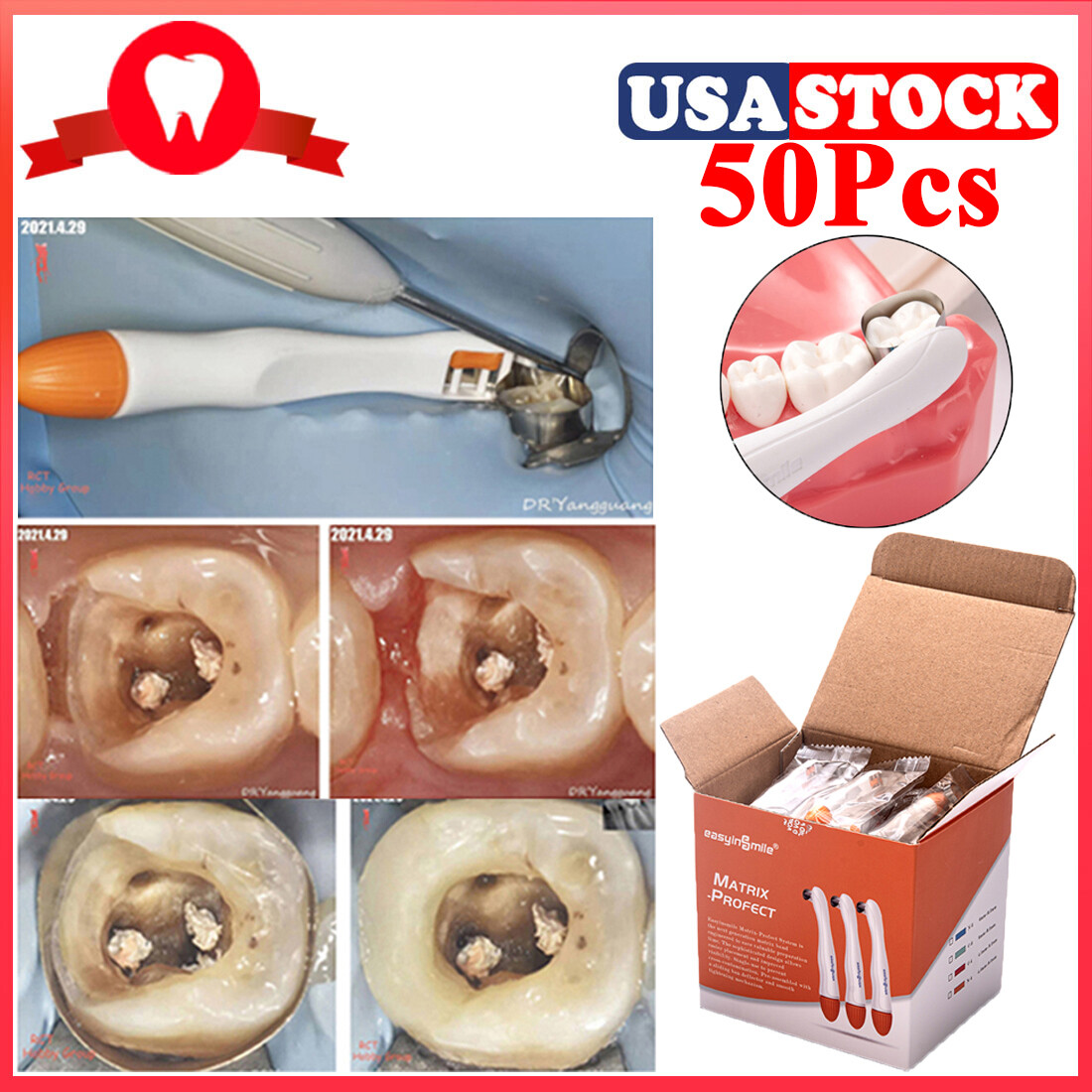 Standard/Curved Dental Pro Matrix Band Pre-formed Interproximal Separators 50pcs