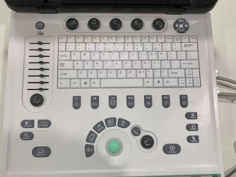 New 15 inch portable Laptop ultrasound Color Doppler machine with three probes