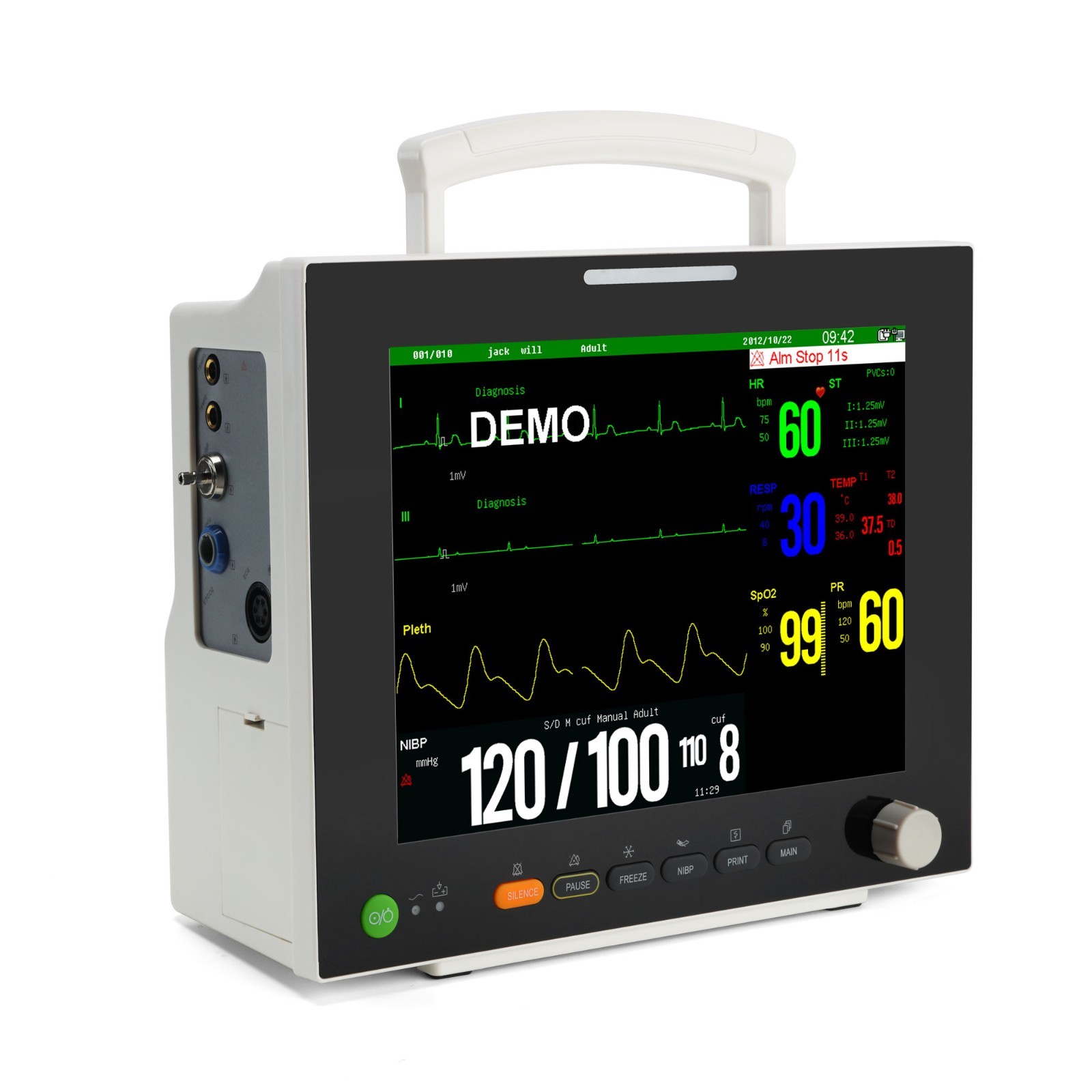 12.1″ TFT Patient Monitor ECG/NIBP/SPO2/RESP/TEMP trends/alarm with Printer