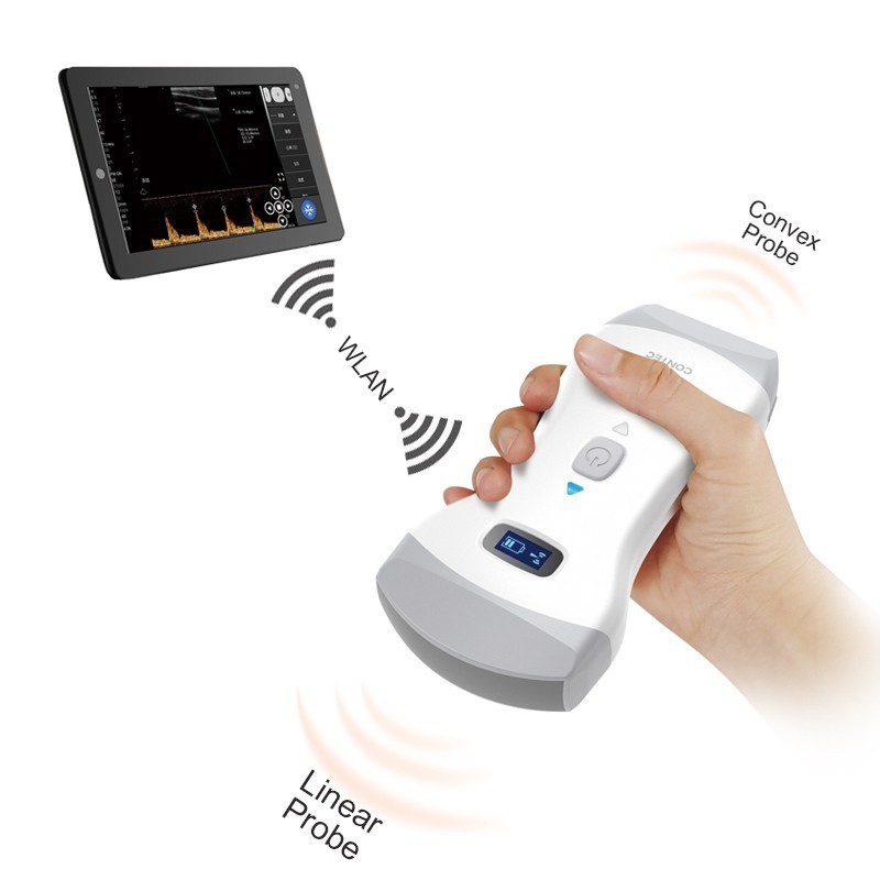 Wireless color Doppler ultrasound device with 3-in-1 convex probe