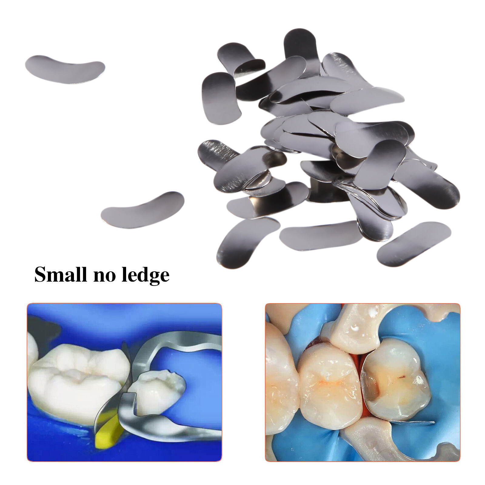 50Pcs Dental Metal Matrices Matrix Band Sectional Contoured Refill S/M/L 35μm MD