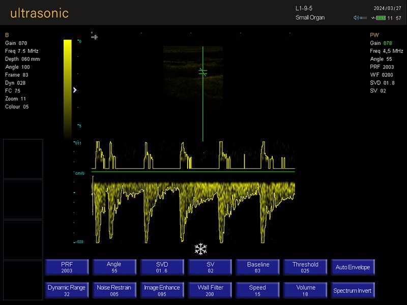 All-Digital Portable Laptop Ultrasound Diagnostic System for Clinic Doctor