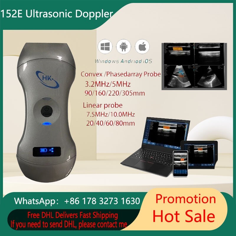 152E 3in1 portable Wireless Ultrasound scanner Wireless Color Ultrasound Doppler