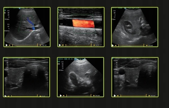 New 15 inch portable Laptop ultrasound Color Doppler machine with three probes