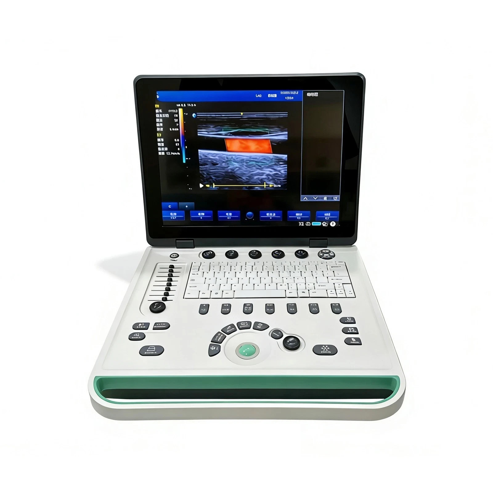 New 15 inch portable Laptop ultrasound Color Doppler machine with three probes