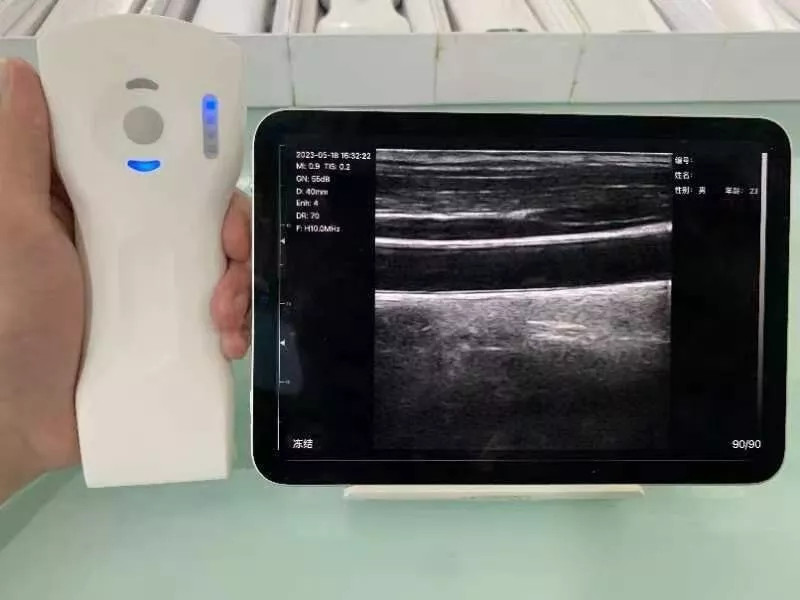 Wifi Wireless Color Ultrasound Doppler Scanner 256E 3 in 1 (64 Channels)