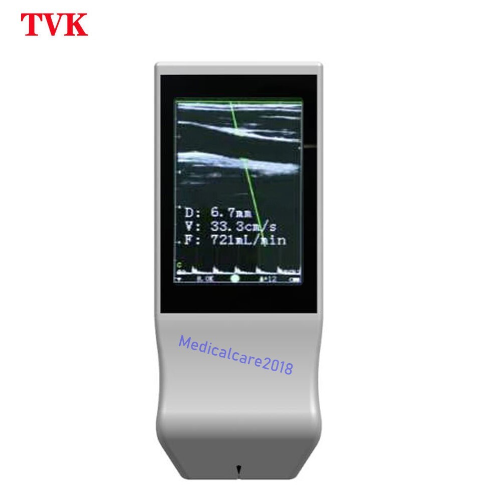 Portable Wireless WiFi Color Doppler linear Ultrasound Scanner, 128 Elements