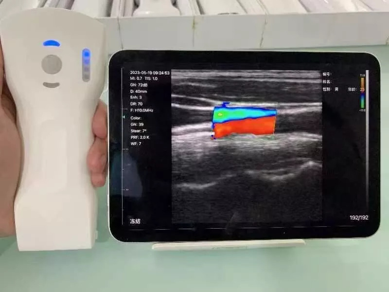 Wifi Wireless Color Ultrasound Doppler Scanner 256E 3 in 1 (64 Channels)