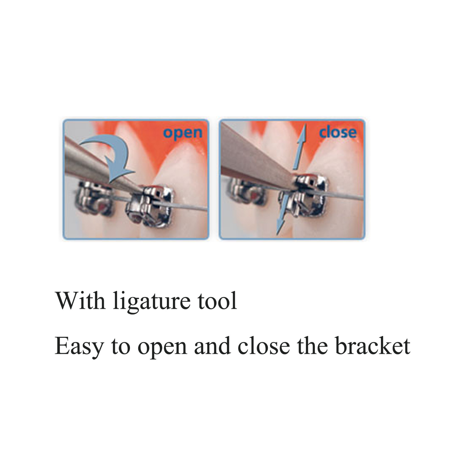 Dental Orthodontic Brackets Mini Self Ligating Metal Roth MBT 022 DAMON Empower