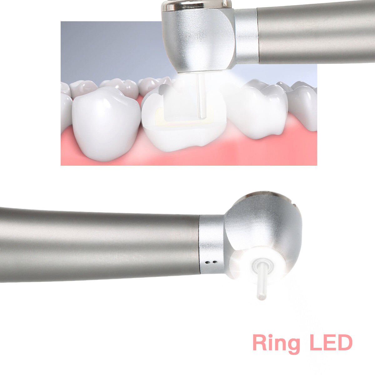 Dental E-generator Shadowless Ring LED High Speed Handpiece Ceramic Bearing 2/4H