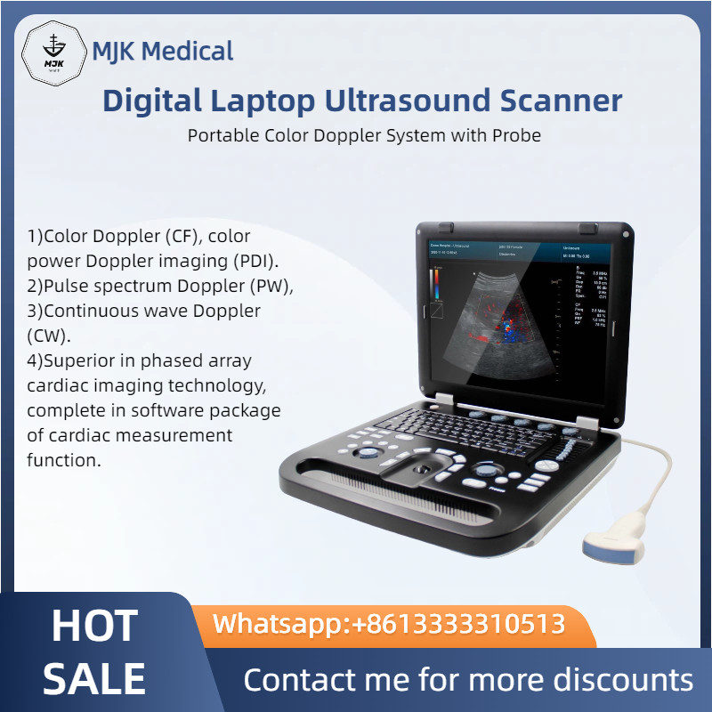 Digital Laptop Ultrasound Scanner – Portable Color Doppler System with Probe