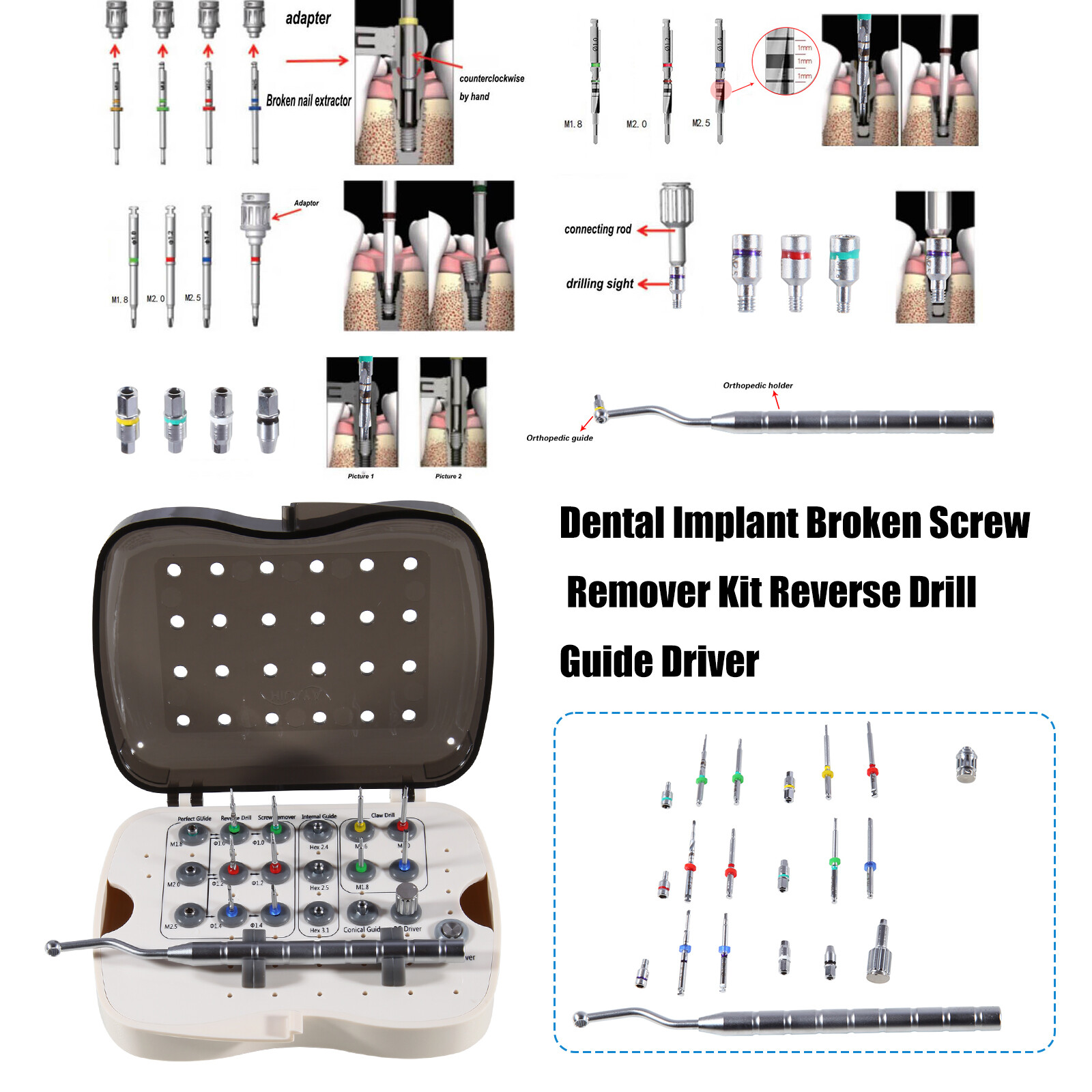 Dental Implant Broken Screw Remover Kit Reverse Drill Guide Driver SR Neobiotech