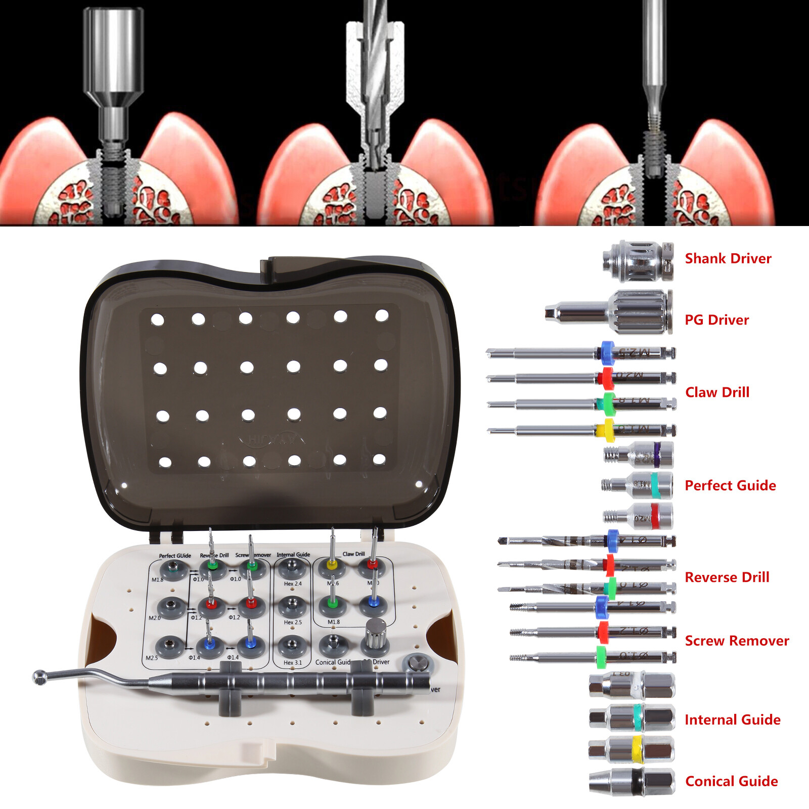 Dental Implant Broken Screw Remover Kit Reverse Drill Guide Driver SR Neobiotech