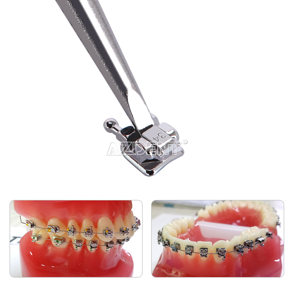 AZDENT Brackets de Autoligado Pasivo para Ortodoncia Dental MBT 022 Ganchos 345