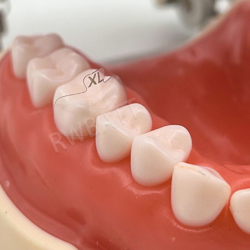 Dental Matrix Bands Ring Sectional Matrice Clamp Clear Anterior Matrix System