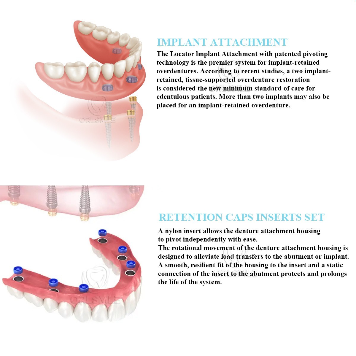 Locator abutment attachment full Set fit to Straumann RN GH1-6mm