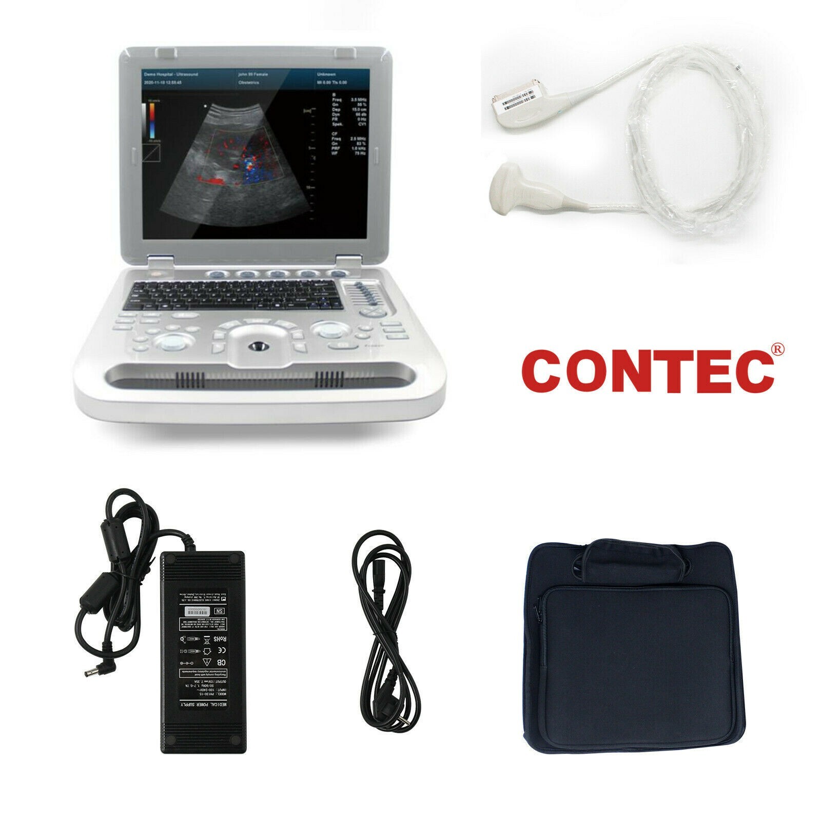 CMS1700A-VET Color Doppler 15″ Portable Laptop Convex Probe Animal Ultrasound