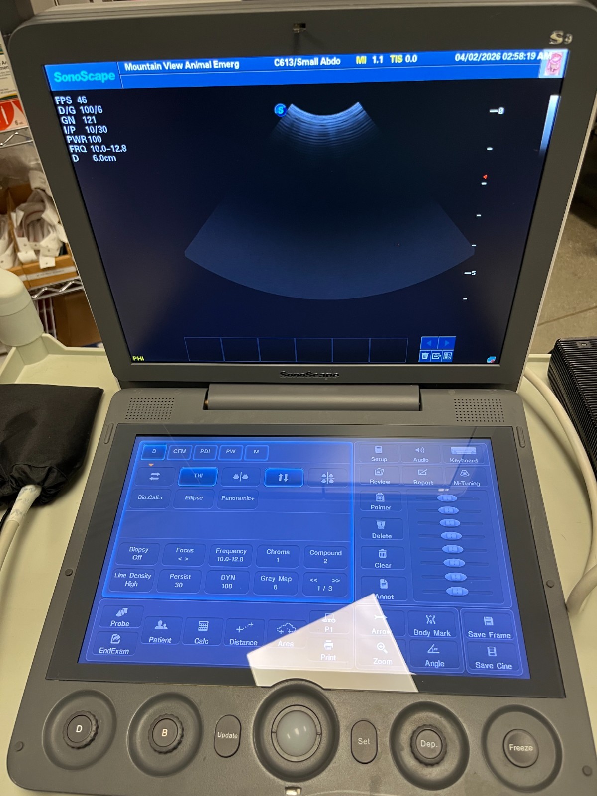 2018 Sonoscape S9 Portable Digital Color Doppler Ultrasound System