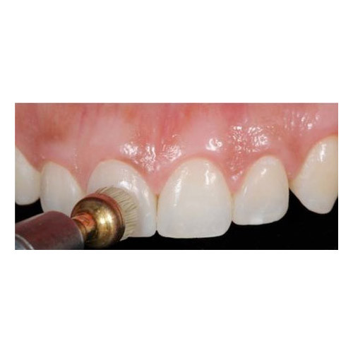 Dental Diamond Polishing Coarse Paste Luster Gloss Composite Ceramic