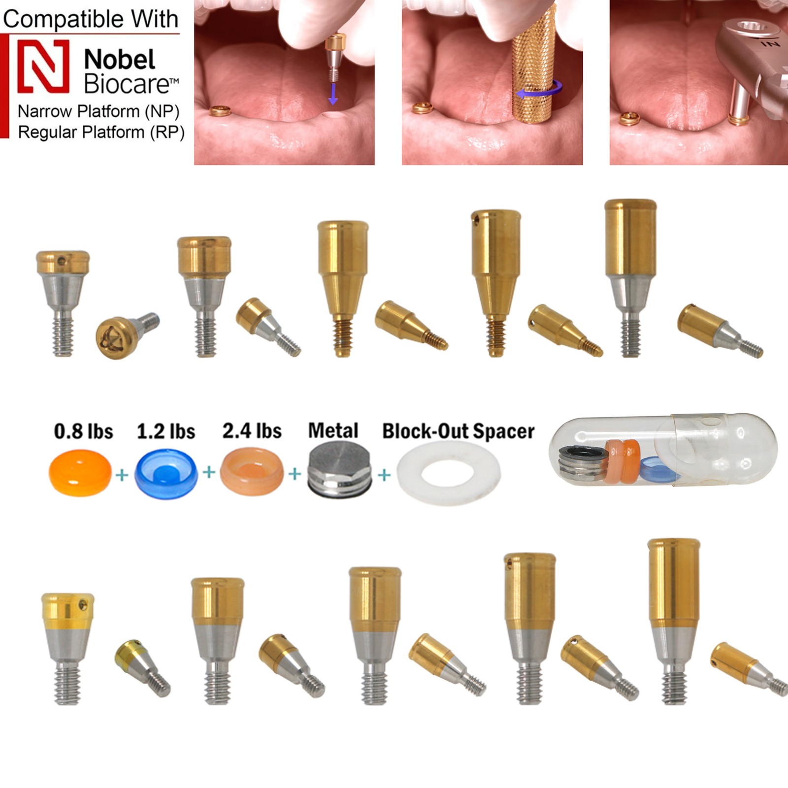 Dental Overdenture Zest Locator Abutment Legacy Anchor Hiossen Nobel Zimmer Cap