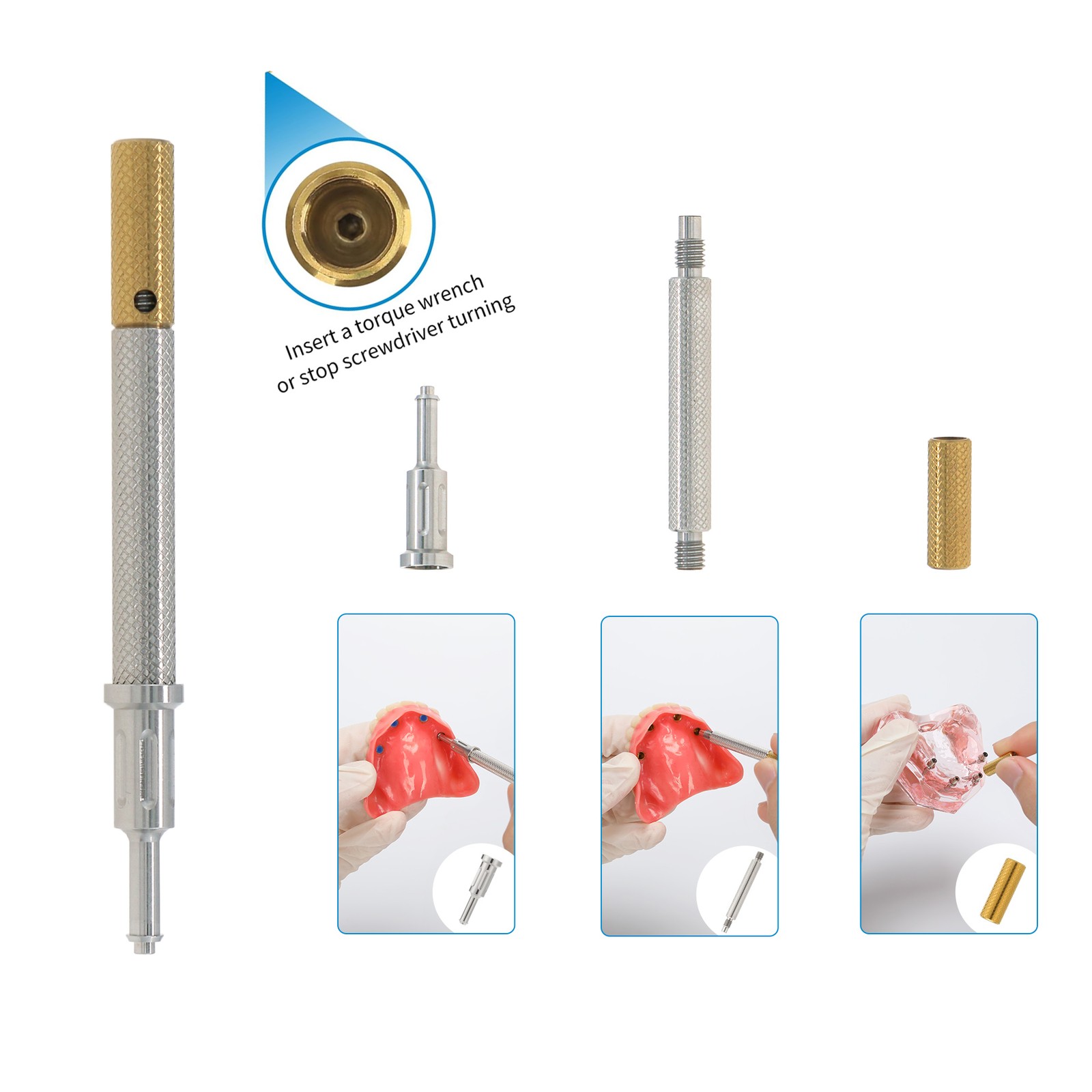 Locator Universal Overdenture 1.2/2.4lbs Retention Caps & Metal Housing Lab Cap