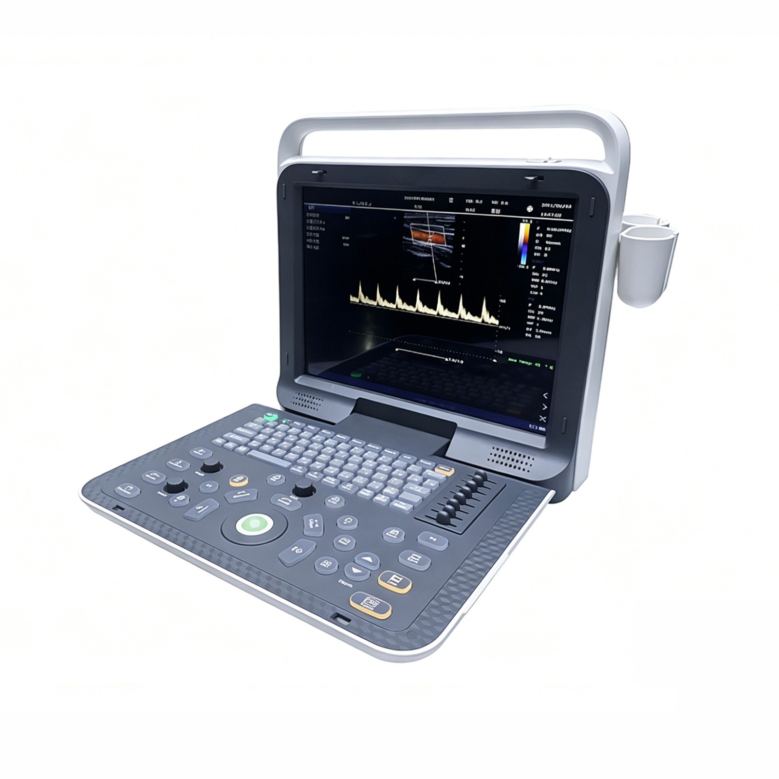 15″ High-Res Progressive Scan Wide-Angle Color Doppler Ultrasound Scanner