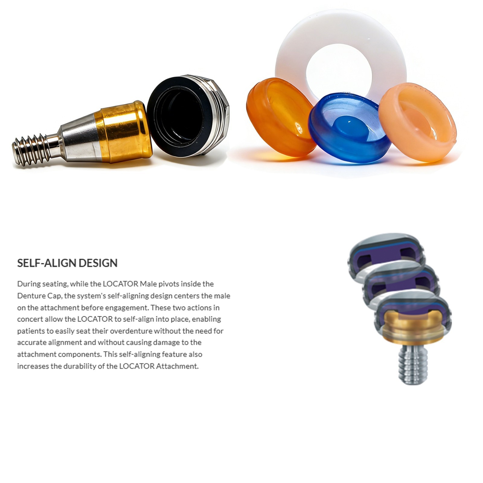 US Hiossen ET Locator Anchor Mini/Regular Implant Retained Removable Overdenture