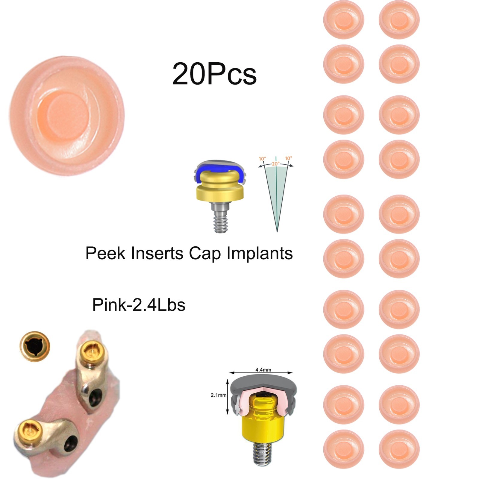 US Zest Locator system Male Cap Inserts 20Pcs Standard Replacement Compatible