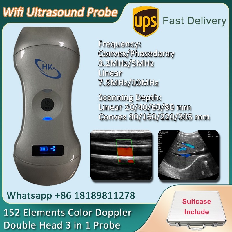 152 Elements 3 in 1 Wireless Color Doppler Ultrasound Probe Convex Linear