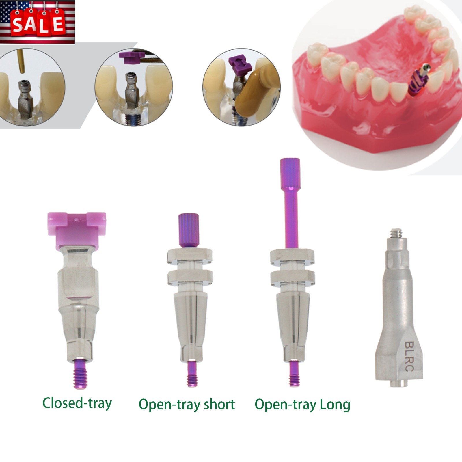 US Dental Impression Coping & Scan Body For Straumann RC BL/BLT Open/Closed Tray