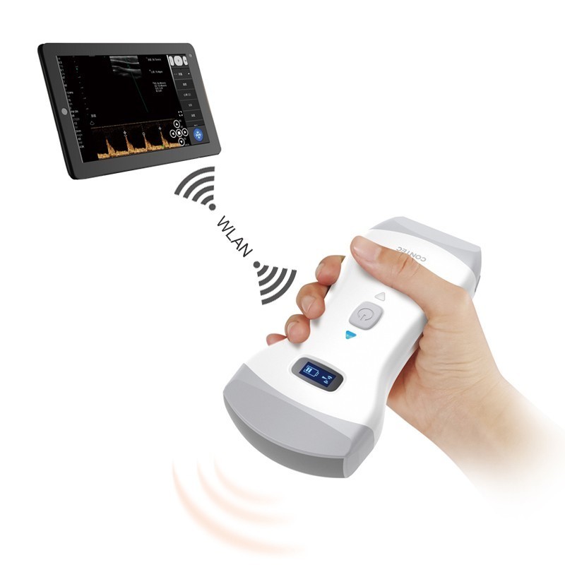 Wireless color Doppler ultrasound device with 3-in-1 convex probe