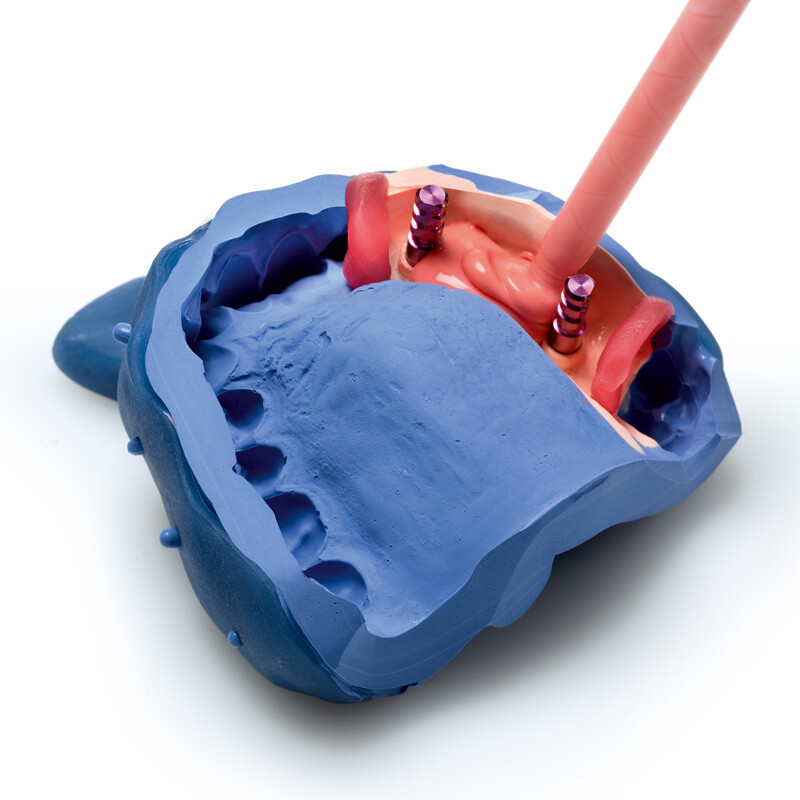 Zhermack Gingifast CAD Rigid Lab-a-Silicone Dental Impression Material C203232