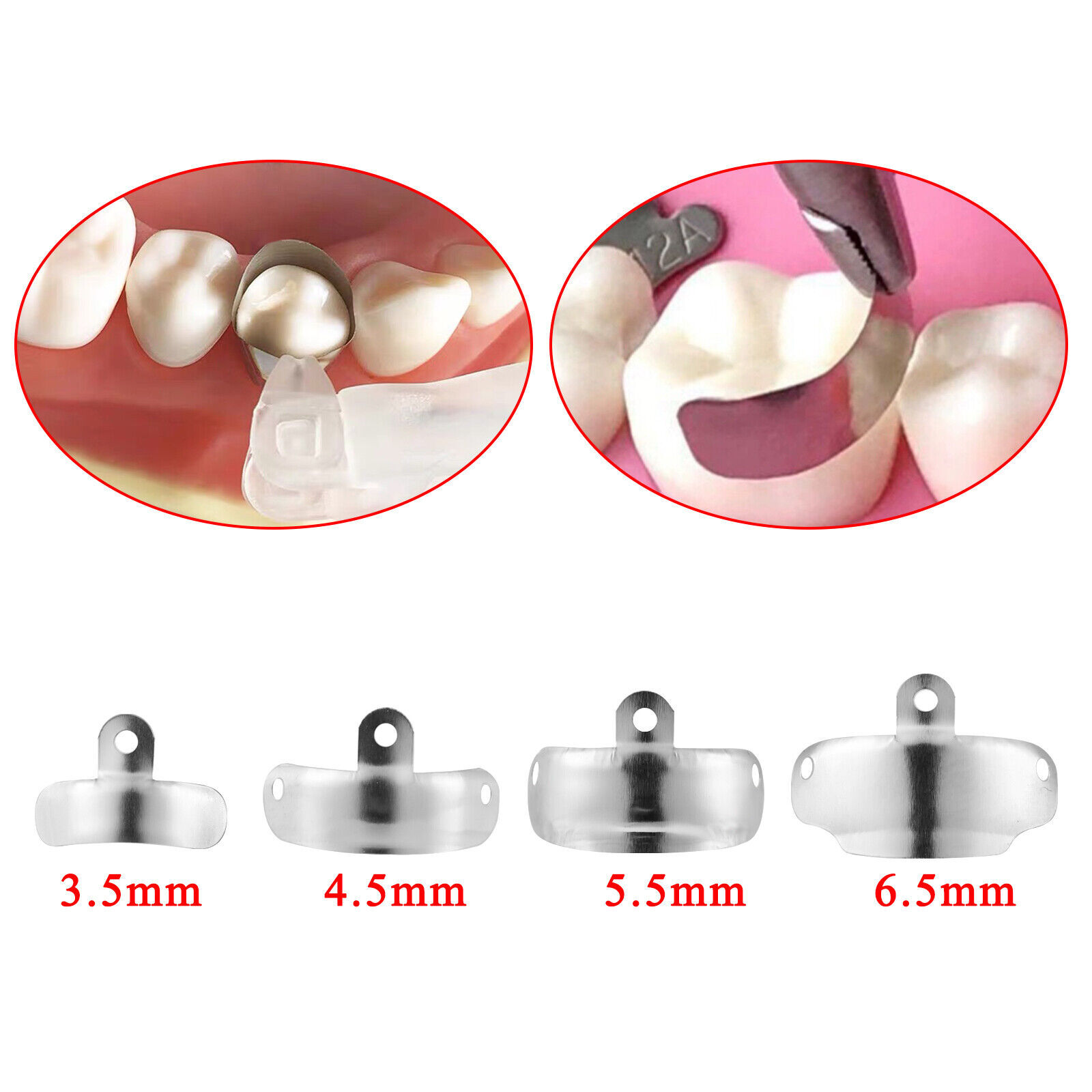 Dental Matrix Bands Ring Narrow Standard Ring Titanium Clamp Fit Garrison V3